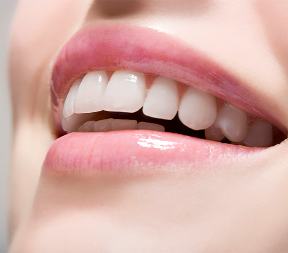 ホワイトニング